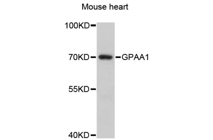 Western Blot - Anti-GPAA1 Antibody (A13853) - Antibodies.com