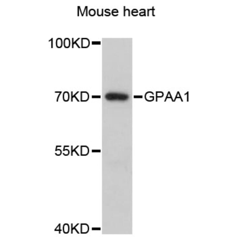 Western Blot - Anti-GPAA1 Antibody (A13853) - Antibodies.com