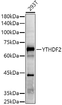 Western blot analysis of extracts of various cell lines, using Anti-YTHDF2 Antibody (A15616) at 1:1,000 dilution.
Secondary antibody: Goat Anti-Rabbit IgG (H+L) (HRP) (AS014) at 1:10,000 dilution.
Lysates / proteins: 25µg per lane.
Blocking buffer: 3% non-fat dry milk in TBST.
Detection: ECL Basic Kit (RM00020).
Exposure time: 3s.
