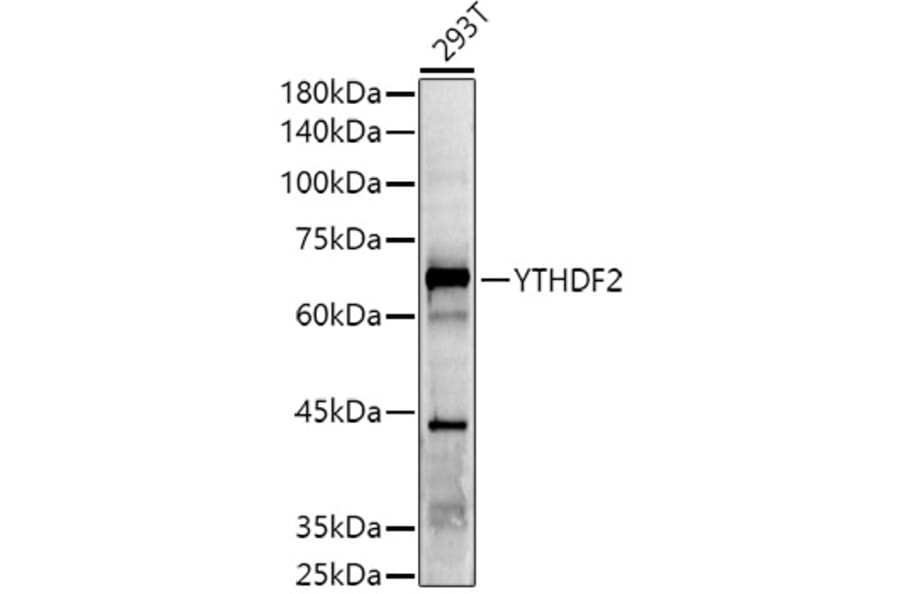 Western Blot - Anti-YTHDF2 Antibody (A90915) - Antibodies.com