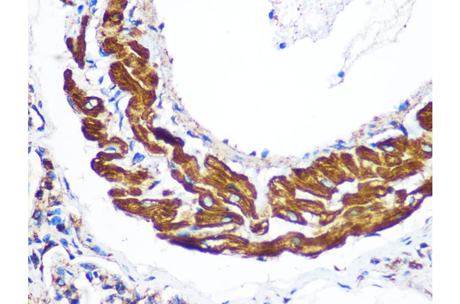 Immunohistochemistry - Anti-YTHDF2 Antibody (A90915) - Antibodies.com
