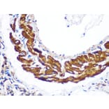 Immunohistochemistry - Anti-YTHDF2 Antibody (A90915) - Antibodies.com