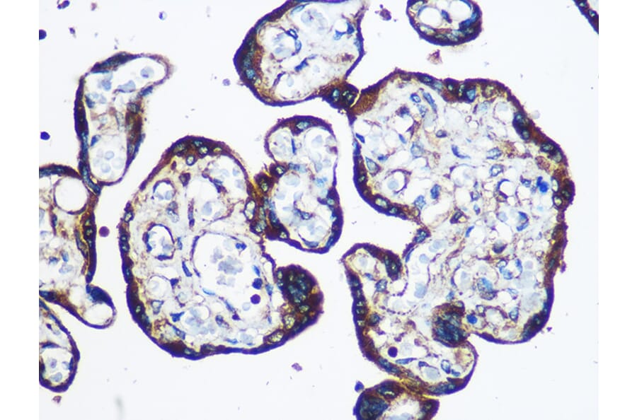 Immunohistochemistry - Anti-YTHDF2 Antibody (A90915) - Antibodies.com