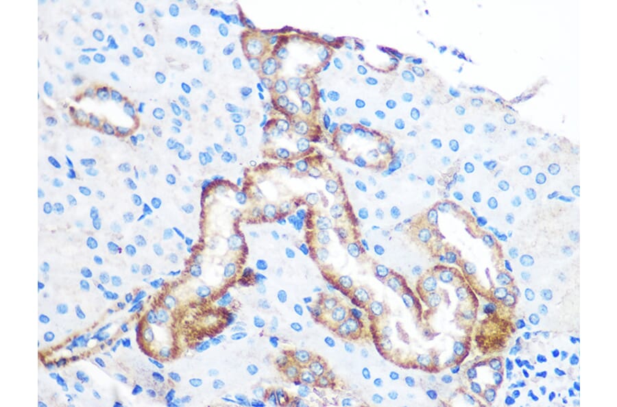 Immunohistochemistry - Anti-YTHDF2 Antibody (A90915) - Antibodies.com