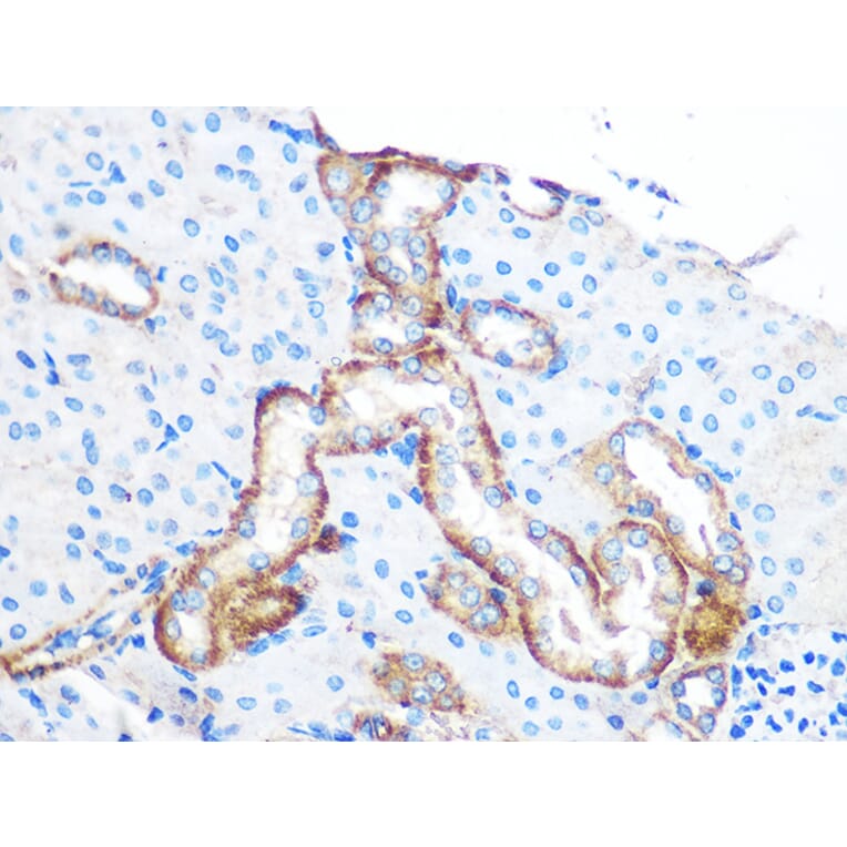 Immunohistochemistry - Anti-YTHDF2 Antibody (A90915) - Antibodies.com