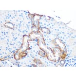 Immunohistochemistry - Anti-YTHDF2 Antibody (A90915) - Antibodies.com