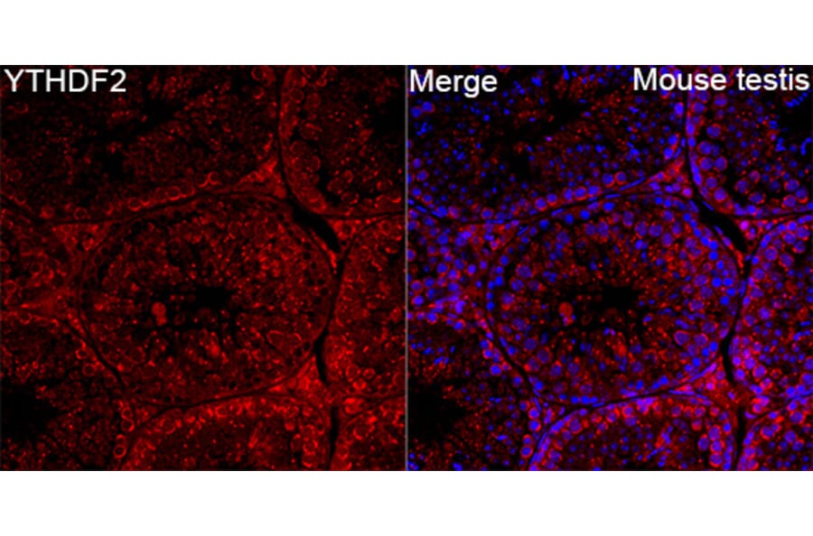 Immunofluorescence - Anti-YTHDF2 Antibody (A90915) - Antibodies.com