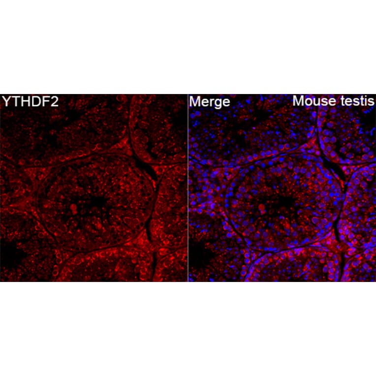 Immunofluorescence - Anti-YTHDF2 Antibody (A90915) - Antibodies.com