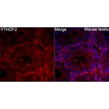 Immunofluorescence - Anti-YTHDF2 Antibody (A90915) - Antibodies.com