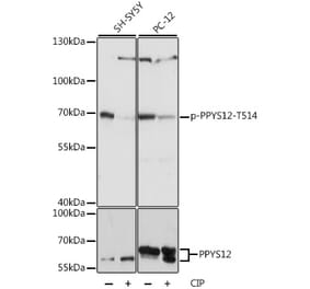 Western Blot - Anti-CRMP2 (phospho Thr514) Antibody (A90916) - Antibodies.com