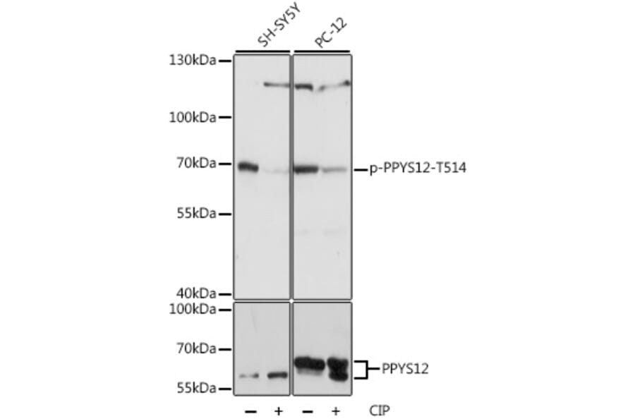 Western Blot - Anti-CRMP2 (phospho Thr514) Antibody (A90916) - Antibodies.com