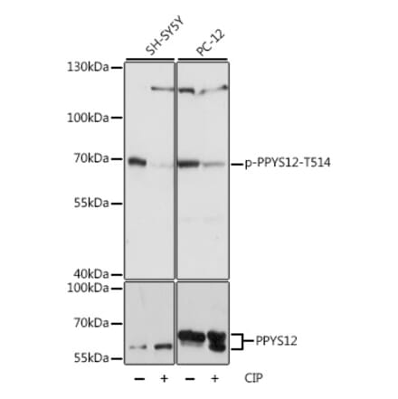 Western Blot - Anti-CRMP2 (phospho Thr514) Antibody (A90916) - Antibodies.com