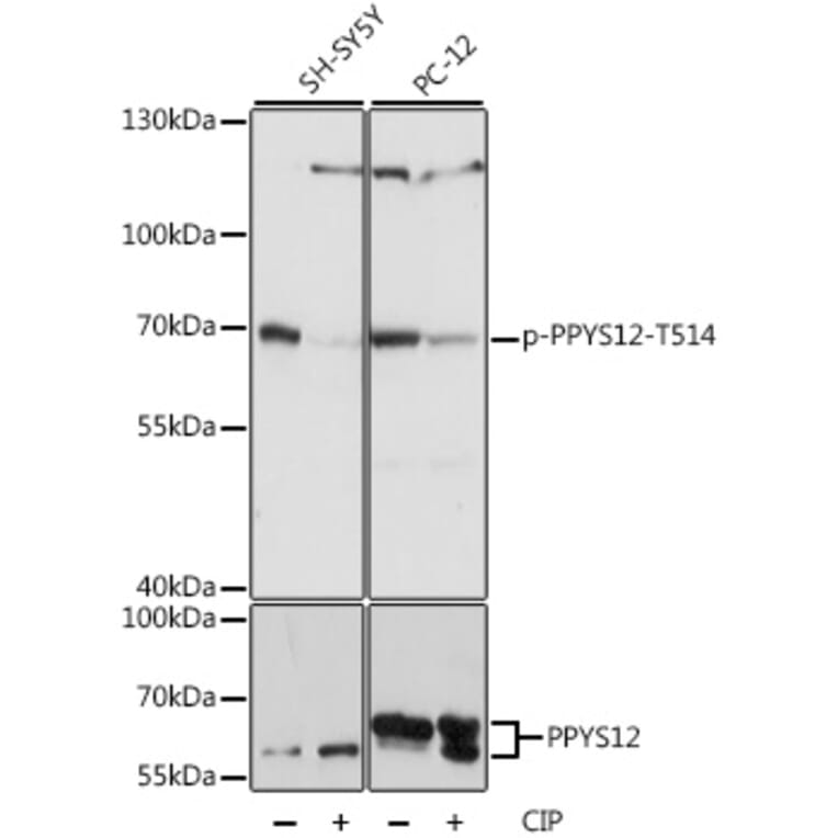 Western Blot - Anti-CRMP2 (phospho Thr514) Antibody (A90916) - Antibodies.com
