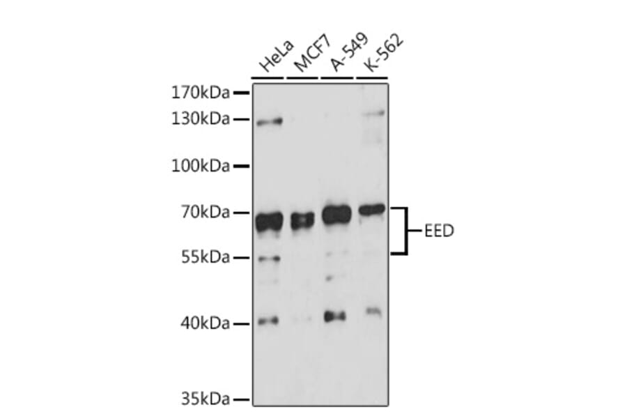 Western Blot - Anti-EED Antibody (A90917) - Antibodies.com