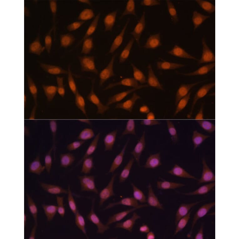 Immunofluorescence - Anti-EED Antibody (A90917) - Antibodies.com