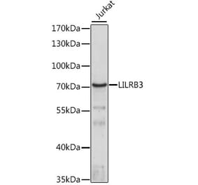 Western Blot - Anti-LILRB3 Antibody (A90918) - Antibodies.com