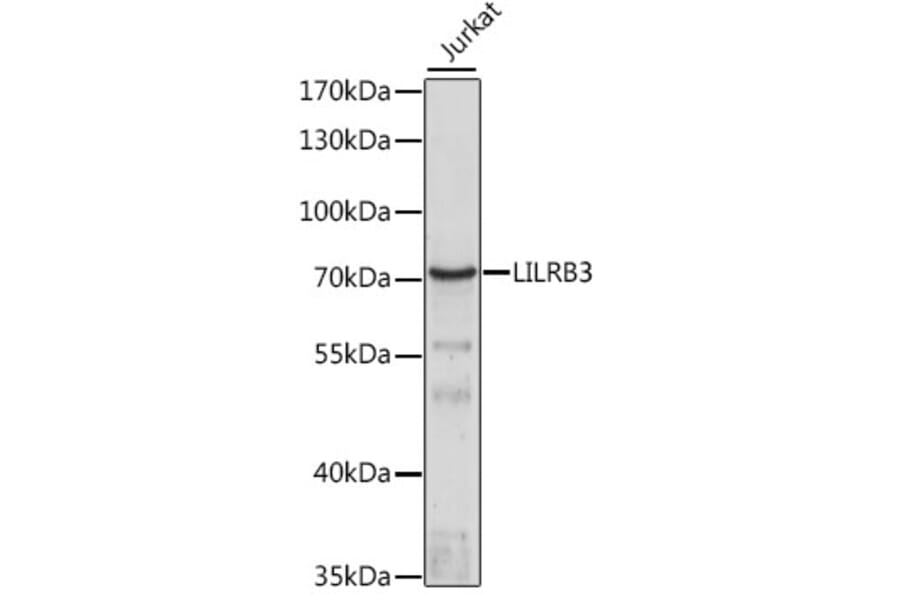 Western Blot - Anti-LILRB3 Antibody (A90918) - Antibodies.com