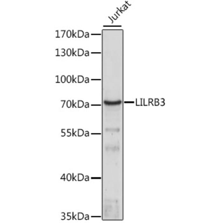 Western Blot - Anti-LILRB3 Antibody (A90918) - Antibodies.com