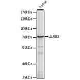 Western Blot - Anti-LILRB3 Antibody (A90918) - Antibodies.com