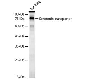 Western Blot - Anti-Serotonin transporter Antibody (A90919) - Antibodies.com