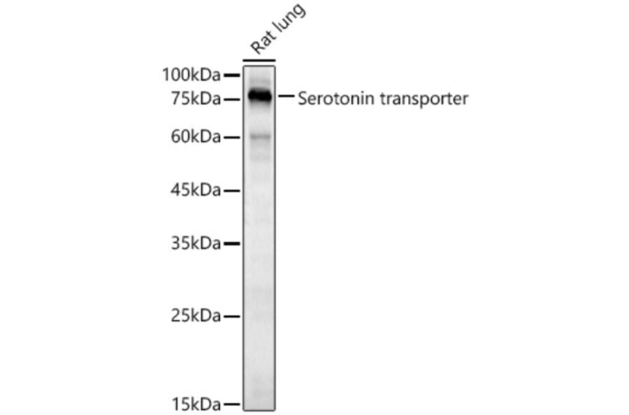 Western Blot - Anti-Serotonin transporter Antibody (A90919) - Antibodies.com