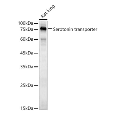 Western Blot - Anti-Serotonin transporter Antibody (A90919) - Antibodies.com