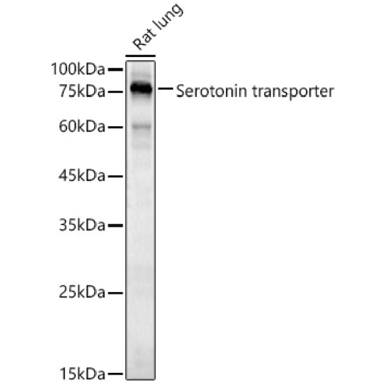 Western Blot - Anti-Serotonin transporter Antibody (A90919) - Antibodies.com