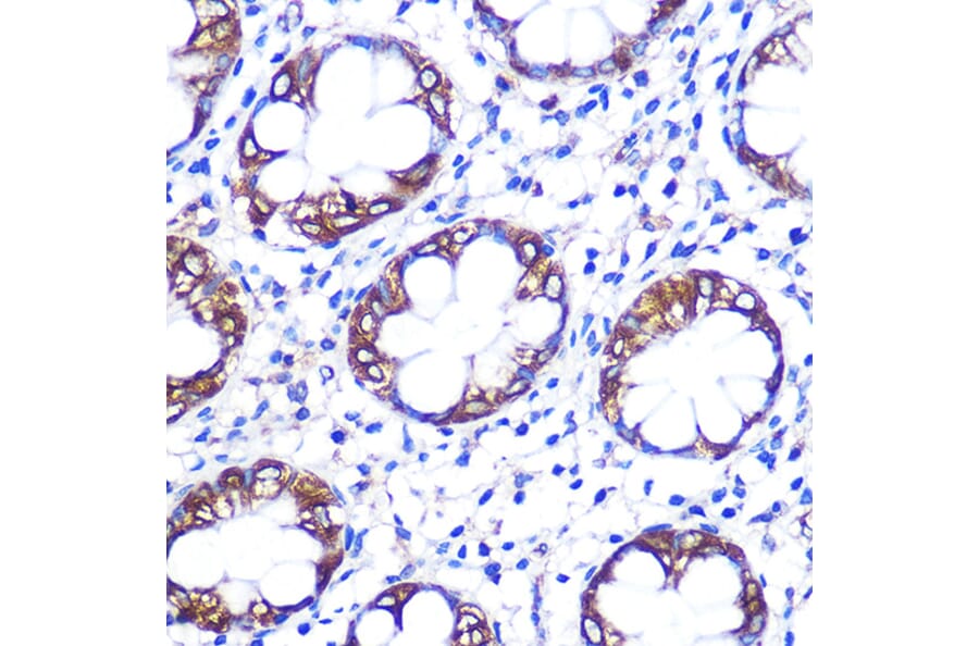 Immunohistochemistry - Anti-Serotonin transporter Antibody (A90919) - Antibodies.com