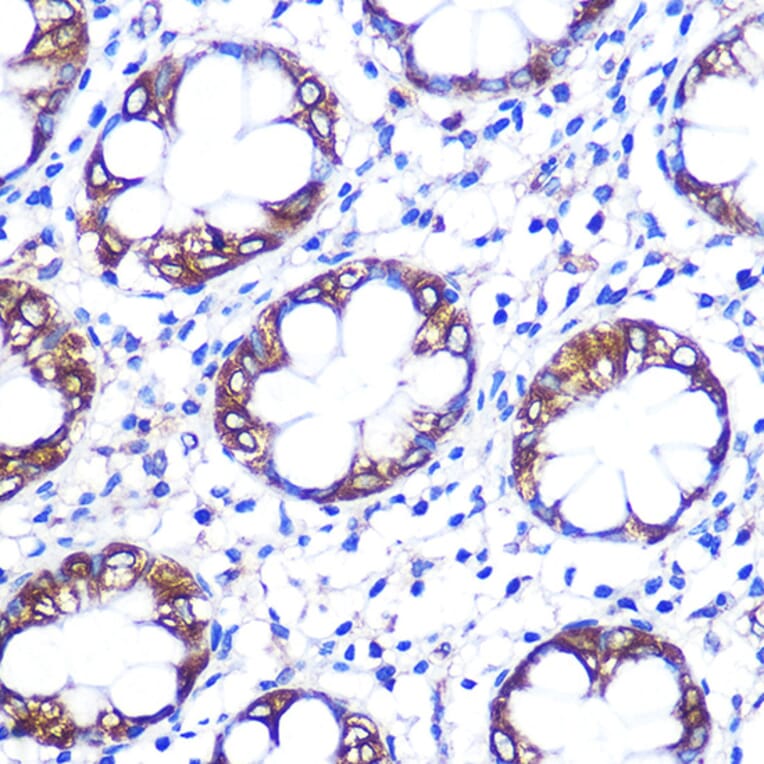 Immunohistochemistry - Anti-Serotonin transporter Antibody (A90919) - Antibodies.com