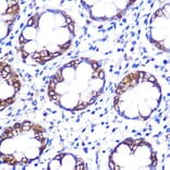 Immunohistochemistry - Anti-Serotonin transporter Antibody (A90919) - Antibodies.com