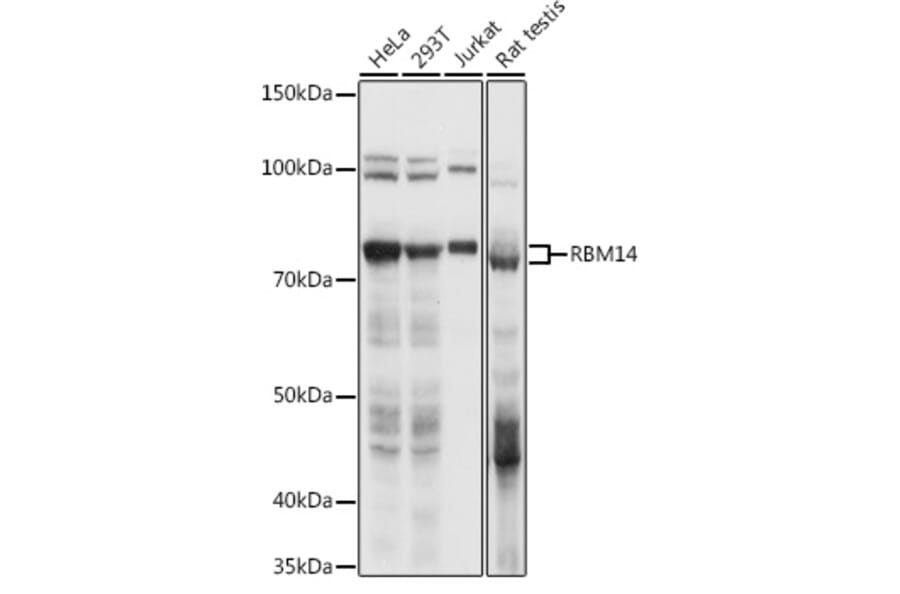 Western Blot - Anti-RBM14 Antibody (A90920) - Antibodies.com