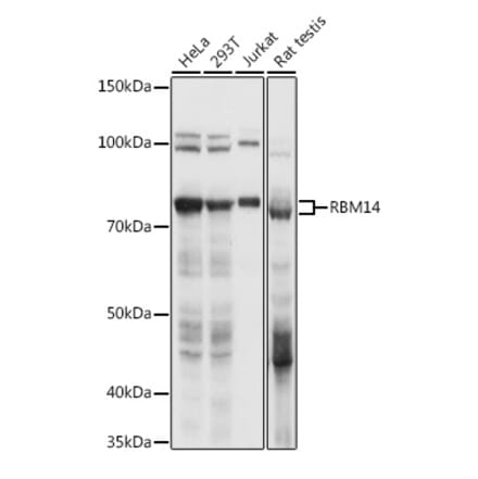 Western Blot - Anti-RBM14 Antibody (A90920) - Antibodies.com