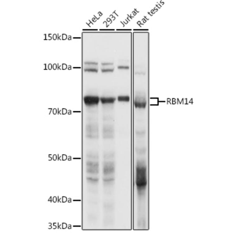 Western Blot - Anti-RBM14 Antibody (A90920) - Antibodies.com