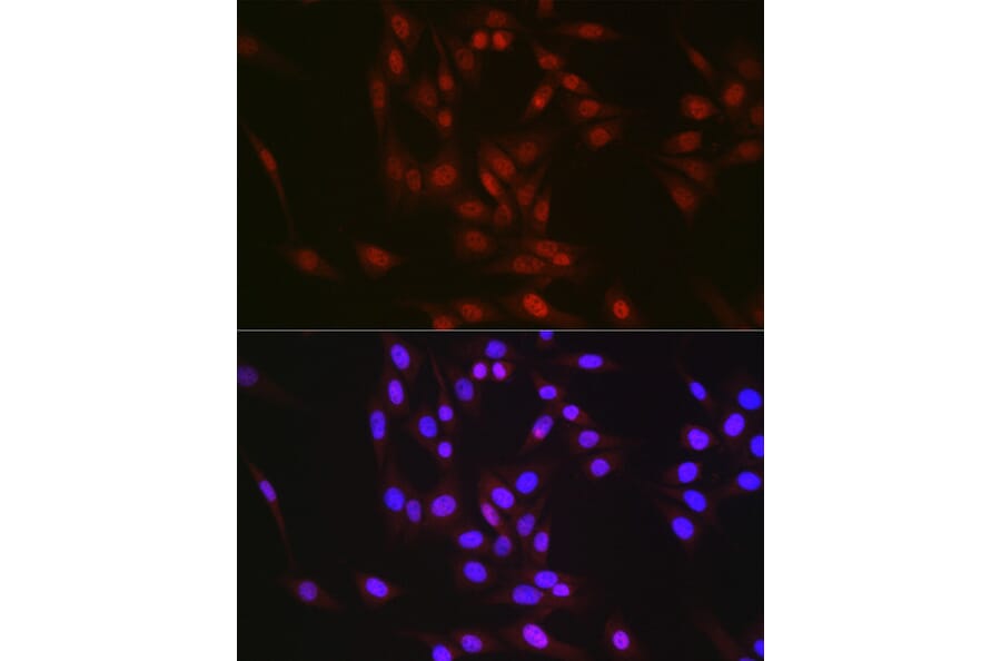 Immunofluorescence - Anti-RBM14 Antibody (A90920) - Antibodies.com