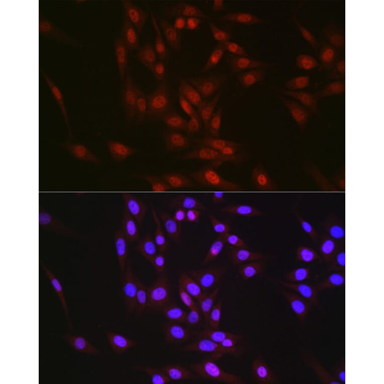 Immunofluorescence - Anti-RBM14 Antibody (A90920) - Antibodies.com