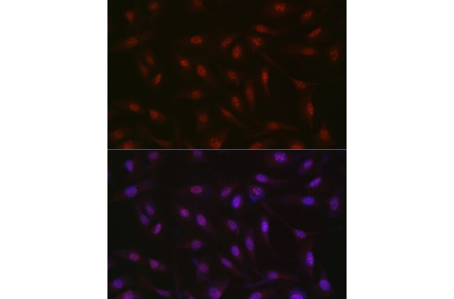 Immunofluorescence - Anti-RBM14 Antibody (A90920) - Antibodies.com