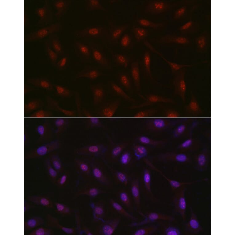 Immunofluorescence - Anti-RBM14 Antibody (A90920) - Antibodies.com