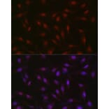 Immunofluorescence - Anti-RBM14 Antibody (A90920) - Antibodies.com