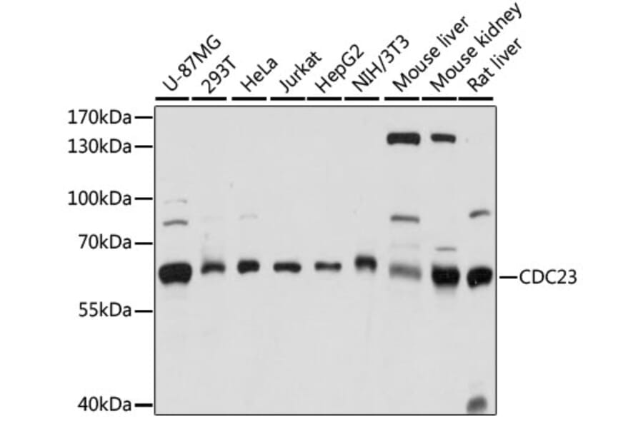 Western Blot - Anti-Cdc23 Antibody (A90921) - Antibodies.com