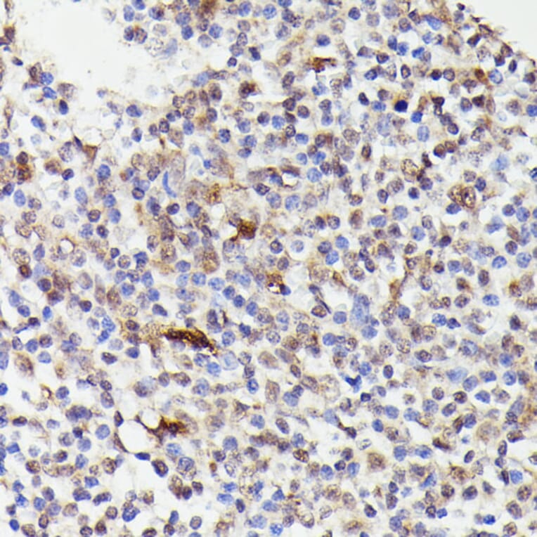 Immunohistochemistry - Anti-Cdc23 Antibody (A90921) - Antibodies.com