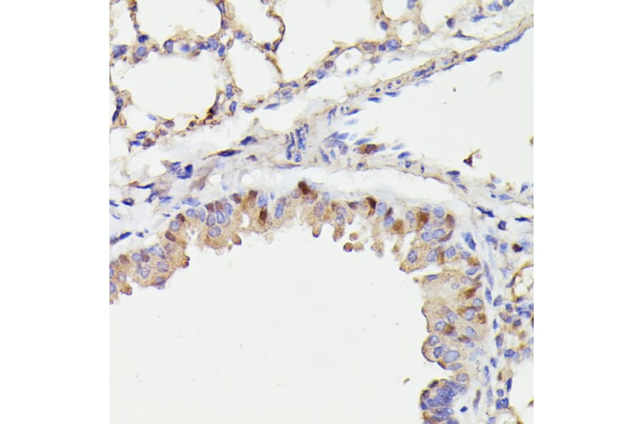 Immunohistochemistry - Anti-Cdc23 Antibody (A90921) - Antibodies.com