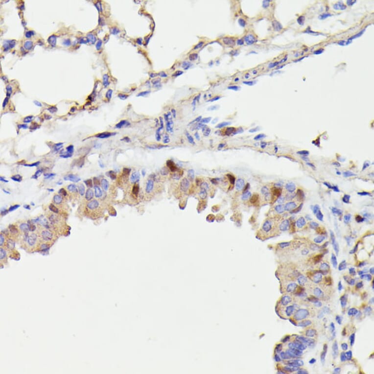 Immunohistochemistry - Anti-Cdc23 Antibody (A90921) - Antibodies.com