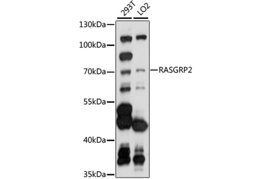 Western Blot - Anti-RASGRP2 Antibody (A90923) - Antibodies.com