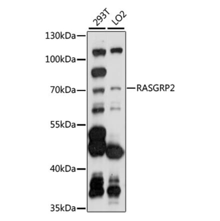 Western Blot - Anti-RASGRP2 Antibody (A90923) - Antibodies.com