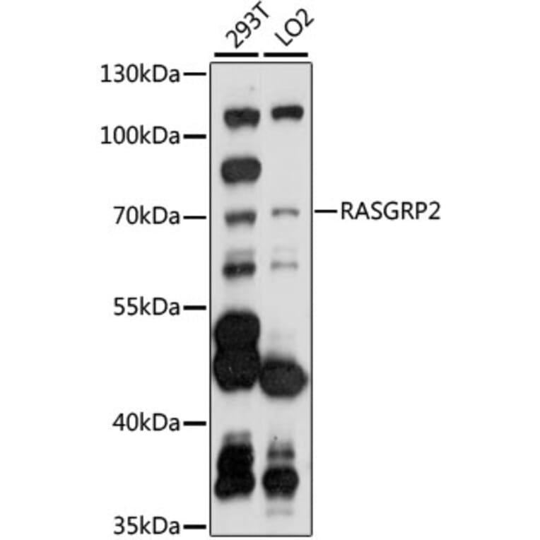 Western Blot - Anti-RASGRP2 Antibody (A90923) - Antibodies.com