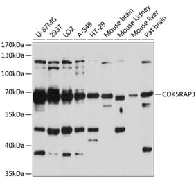 Western Blot - Anti-CDK5RAP3 Antibody (A90924) - Antibodies.com