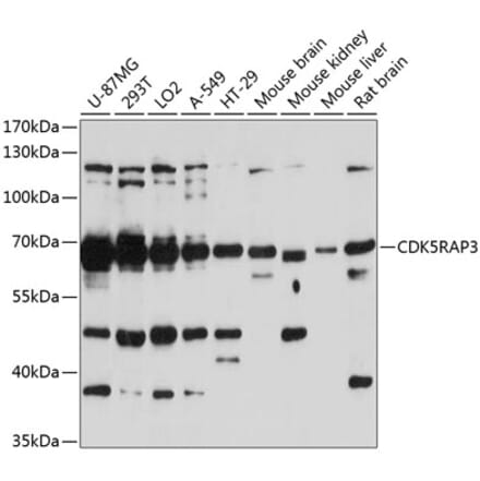 Western Blot - Anti-CDK5RAP3 Antibody (A90924) - Antibodies.com