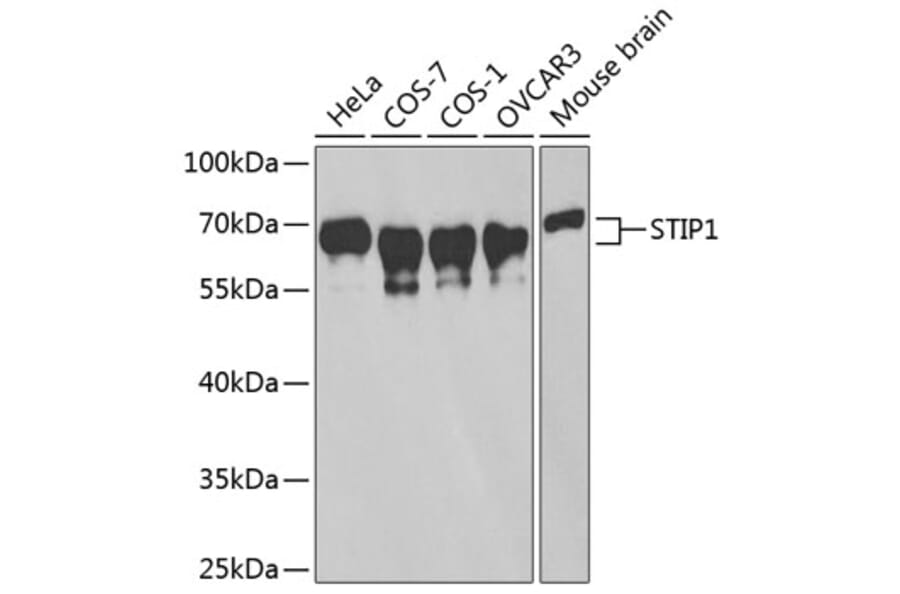 Western Blot - Anti-STIP1/STI1 Antibody (A90925) - Antibodies.com