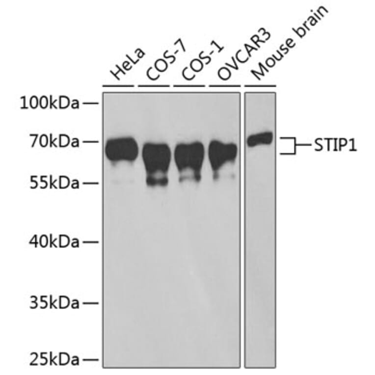 Western Blot - Anti-STIP1/STI1 Antibody (A90925) - Antibodies.com