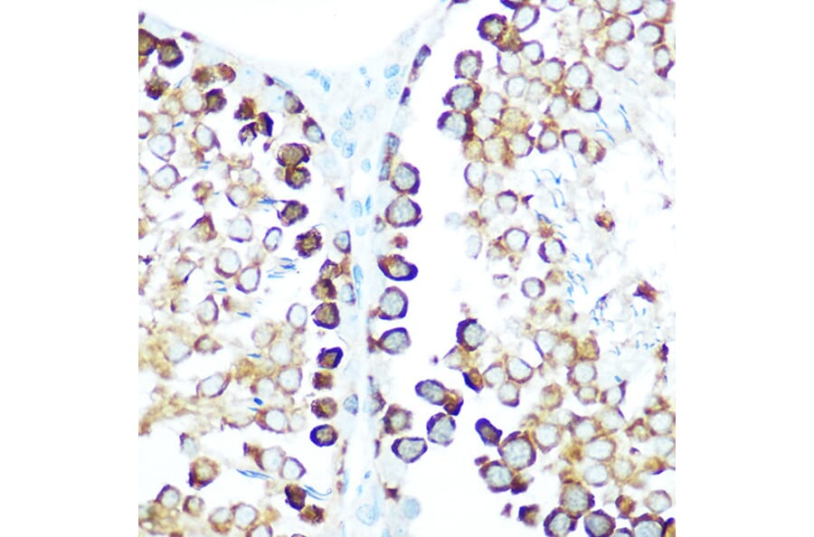 Immunohistochemistry - Anti-STIP1/STI1 Antibody (A90925) - Antibodies.com
